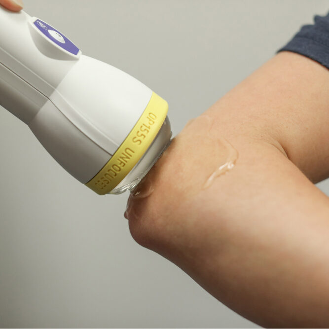 SoftWave Elbow Treatment