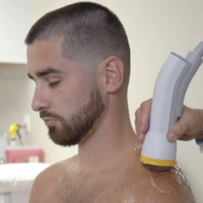 SoftWave shoulder treatment